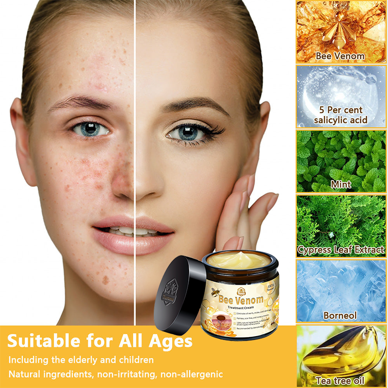 Turonu™ Bee Venom Skin Cream 🍄Approved by the Canadian Academy of Dermatology (CDA and FDA) (helps treat acne, warts, rosacea, psoriasis, age spots, eczema, and reduces the appearance of stretch marks)