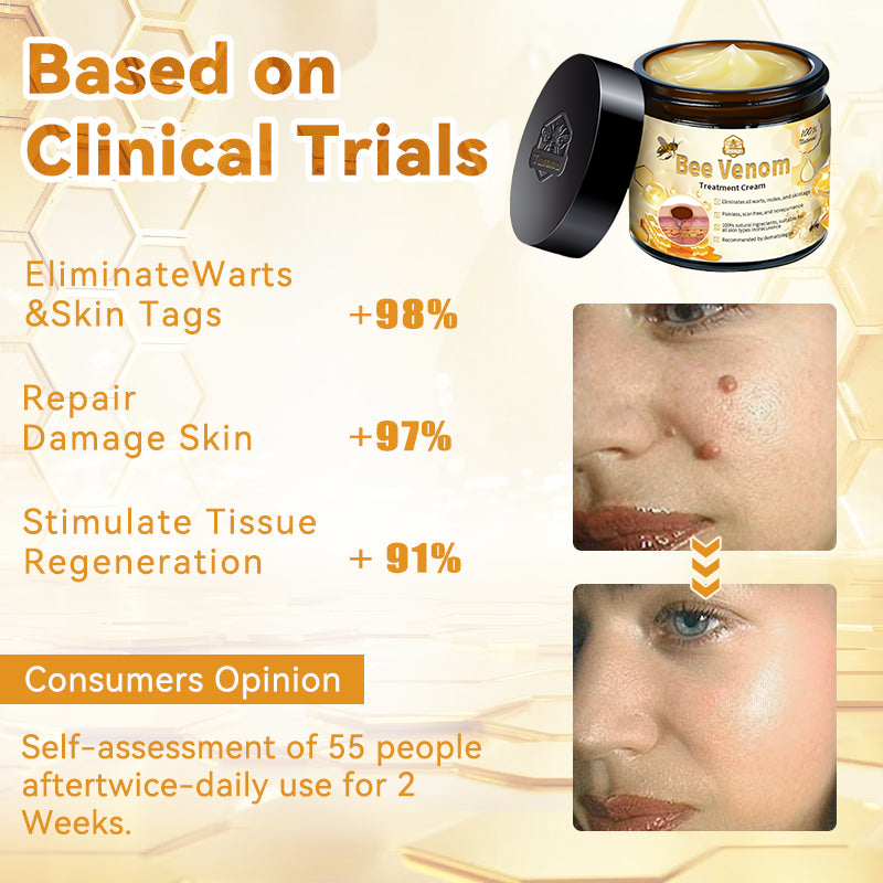 Official Store: Turonu™ Bee Venom Skin Treatment Cream Canadian Dermatology Association(CDA) Approved(Helping with acne, wart, rosacea, psoriasis, age spots, eczema, and reducing the appearance of stretch marks)💥