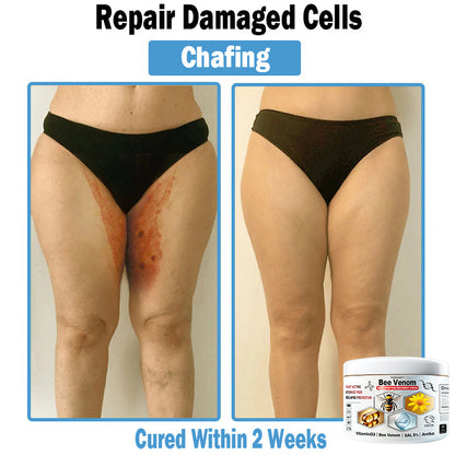 TODAHOF™ Bee Venom Multi-Symptom Skin Treatment Cream (👨‍⚕CDA RECOMMENDS)